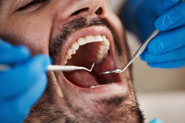 Best Dentist for Tooth Abscess  in Melrose, MN